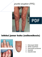 Informasi Dasar HIV AIDS Dan Stadium Klinis