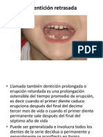 Dentición Retrasada