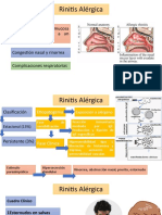 3 Rinitis Alérgica - Rinitis Intrínsica