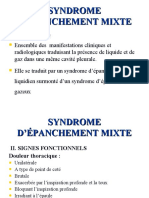 Syndrome D'epanchement Mixte