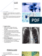 Micosis Oportunista