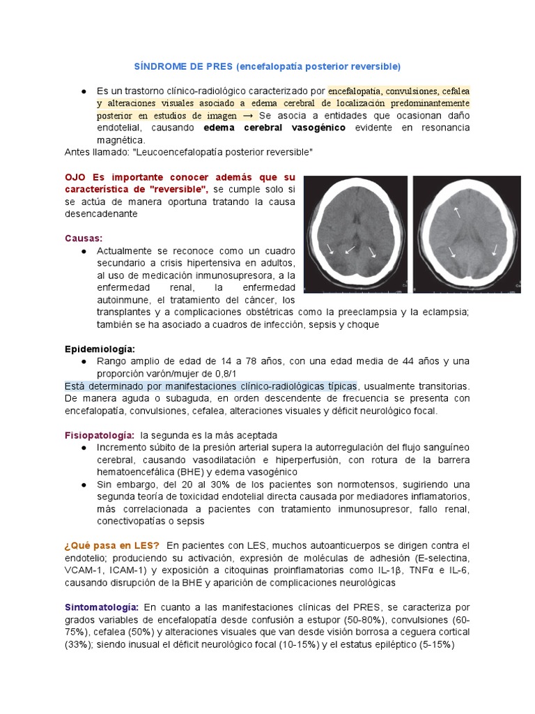 SÍNDROME DE PRES (Encefalopatía Posterior Reversible) | PDF ...