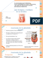 Patologias Benignas y Malignas de Tiroides