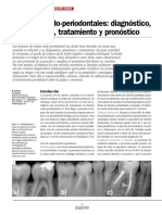 Lesión Endoperiodontal