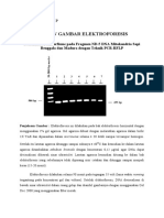 M Ridho R P - 1308618048 - Review Gambar Elektroforesis