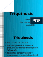 Triquinosis