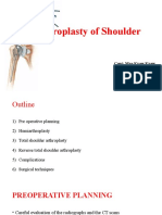 Arthroplasty of Shoulder - MKKPPTX