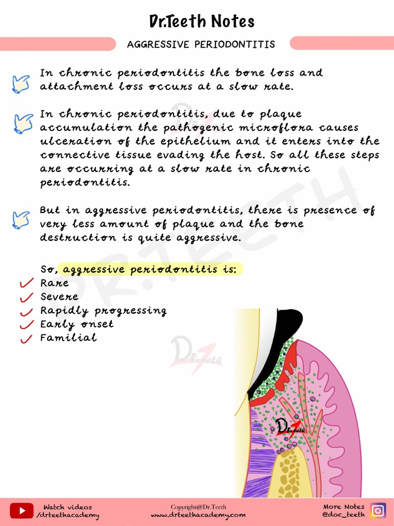 Aggressive Periodontitis | PDF
