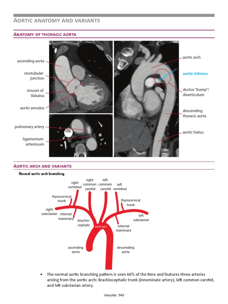 Core Radiology Vascular Imaging PDF