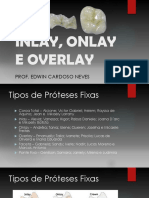 Inlay, Onlay e Overlay - Prof. Edwin
