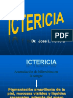 Ictericia