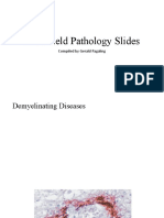 Greenfield Slides - Demyelinating Disease