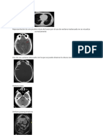 Imágenes comparativas de ventanas tomográficas 