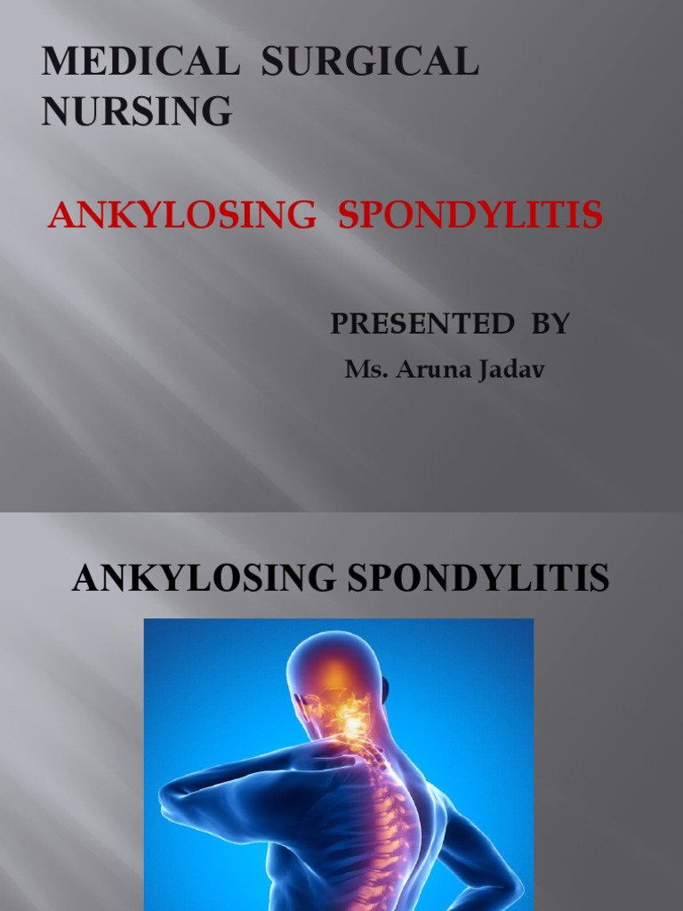 Ankylosing Spondylitis Overview and Management | PDF | Vertebral Column ...
