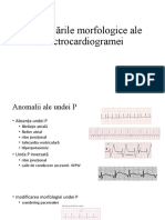 ECG2