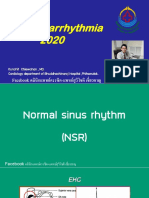 cardiac arrhythmia 2020 คลินิกแพทย์ครรชิค-แพทย์สุวิโชติ เชี่ยวชาญ