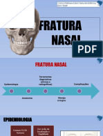 Fratura Nasal