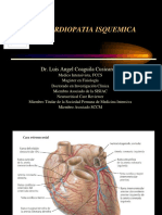 Cardiopatía Isquémica Dr. Coaguila