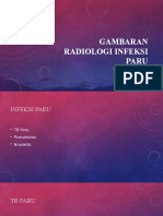 Gambaran Radiologi Infeksi Paru