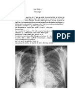 Caso Clinico 3. Infecto