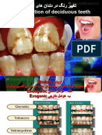 تغییر رنگ در دندان های اطفال