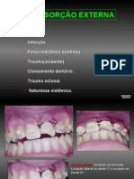 Reabsorção Externa