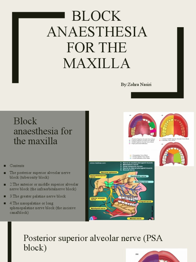 Anasthasia For The Maxilla PDF Human Head And Neck Human Anatomy