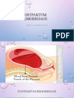 Postpartum Hemorrhage DEG