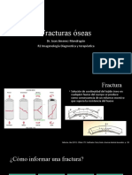 Fracturas Oseas