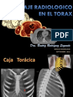 Abordaje Radiologico en El Torax