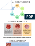 Patologías en Prótesis Total