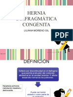 Hernia Diafragmática