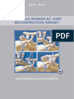 Minimal Imvasive AC Joint Recontruction
