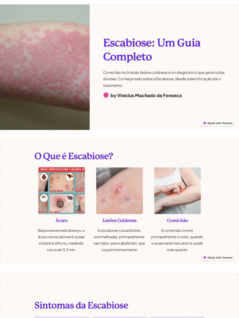 Escabiose Um Guia Completo | PDF