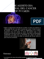 Cancer de Pulmon