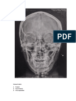 Anatomia RX de Craneo Frente y Perfil