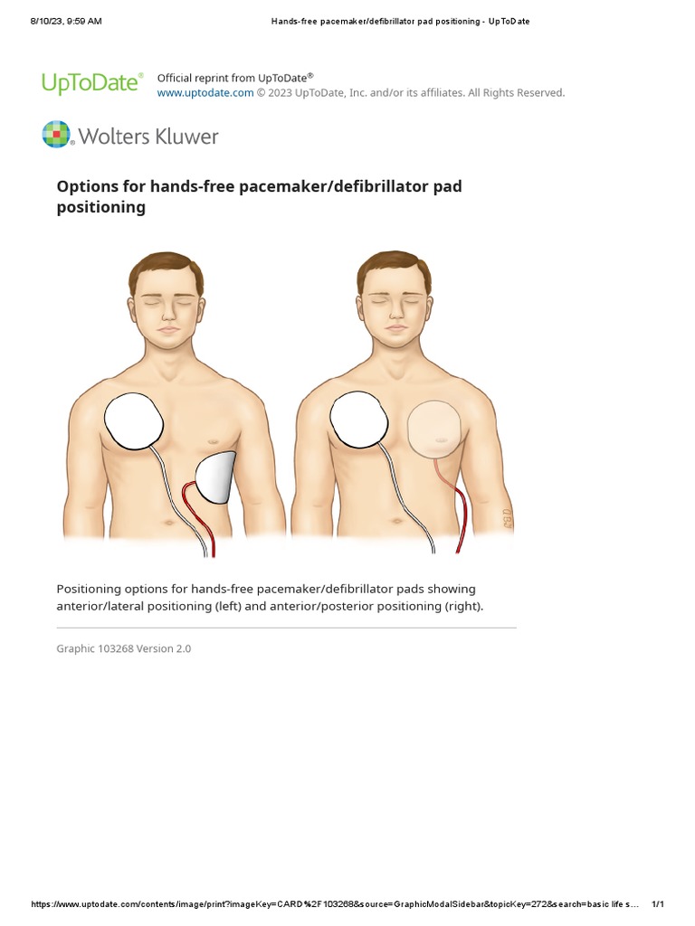 Handsfree pacemaker_defibrillator pad positioning UpToDate PDF