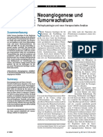 Neoangiogenese Und Tumorwachstum