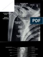 Radiographs Upper Limb