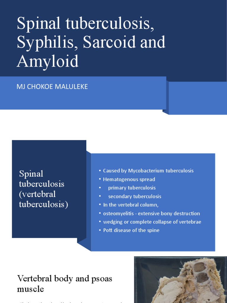 TB Spine, Syphylis, Amyloidosi and Sarcoid by MJC | PDF | Vertebral ...