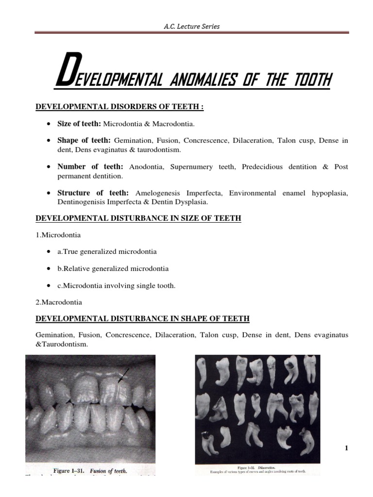 Developmental Anomalies of The Tooth | PDF | Human Tooth | Tooth Enamel