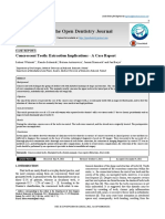 The Open Dentistry Journal: Concrescent Teeth: Extraction Implications - A Case Report