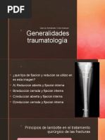 Reducción Abierta y Fijación Interna: RAFI | PDF | Hueso | Traumatologia
