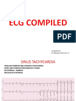 Ecg Compiled