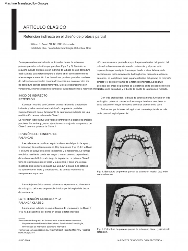 Indirect Retention in Partial Denture Design PDF Dentadura postiza