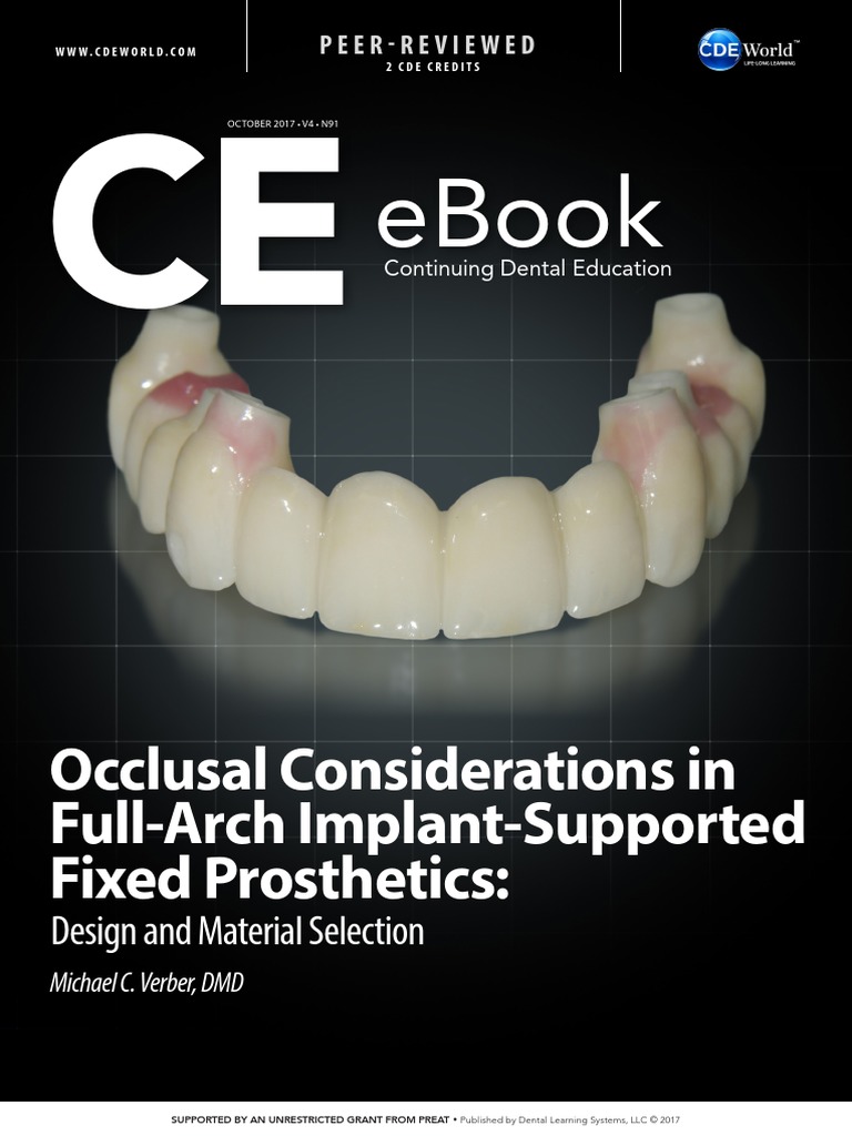 Occlusal Considerations in Full Arch Implant Supported Fixed ...