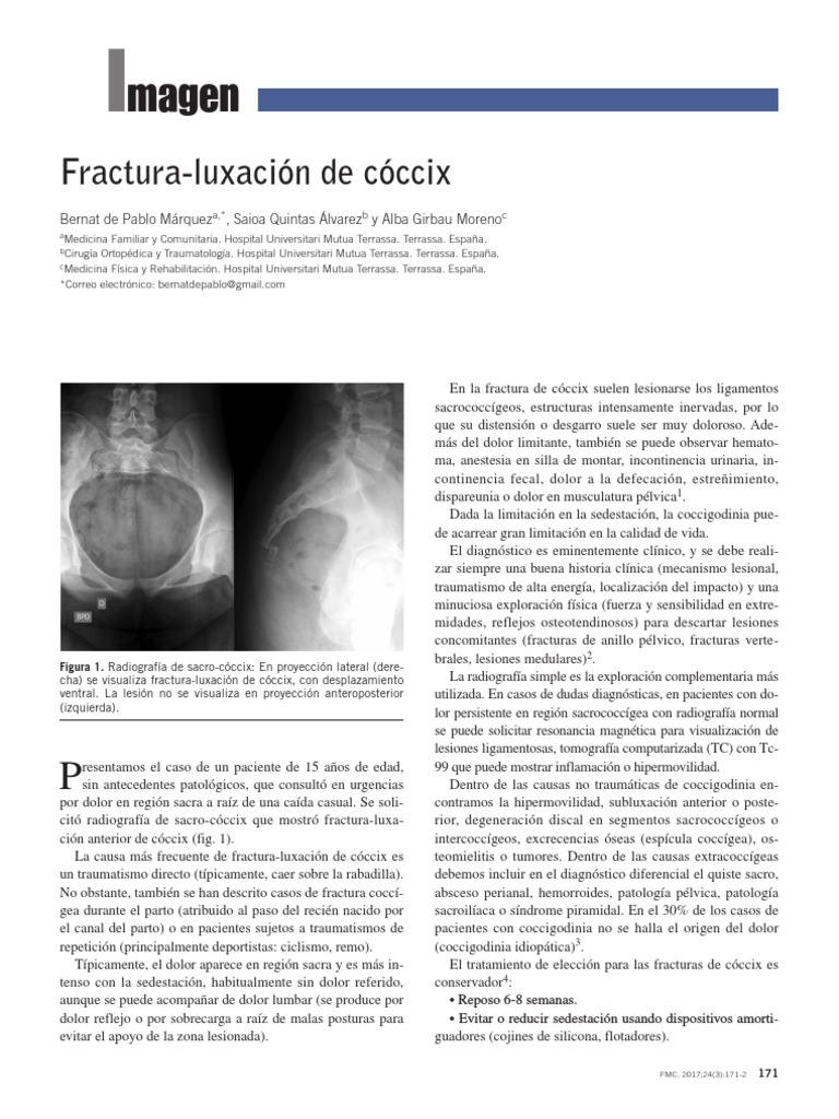fractura-luxaci-n-de-c-ccix-diagn-stico-y-tratamiento-pdf