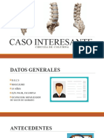 Caso Interesante Columna