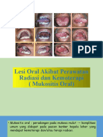 Oral Mukositis
