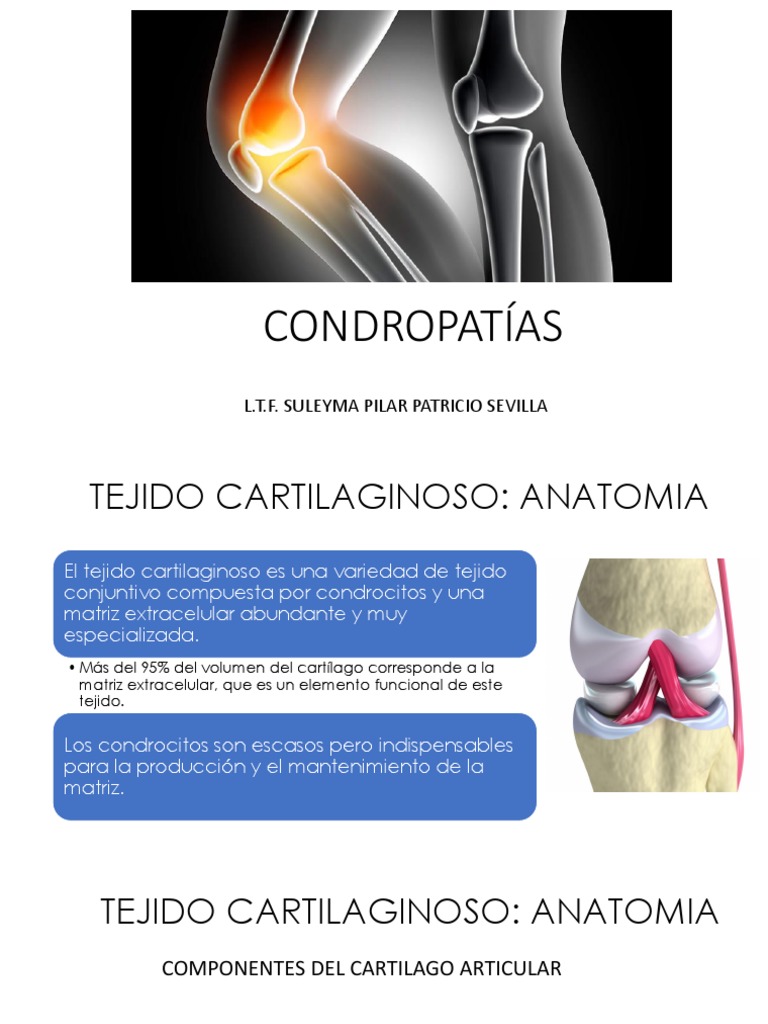 Condropatía Rotuliana: Grados y Factores | PDF | Cartílago | Rodilla